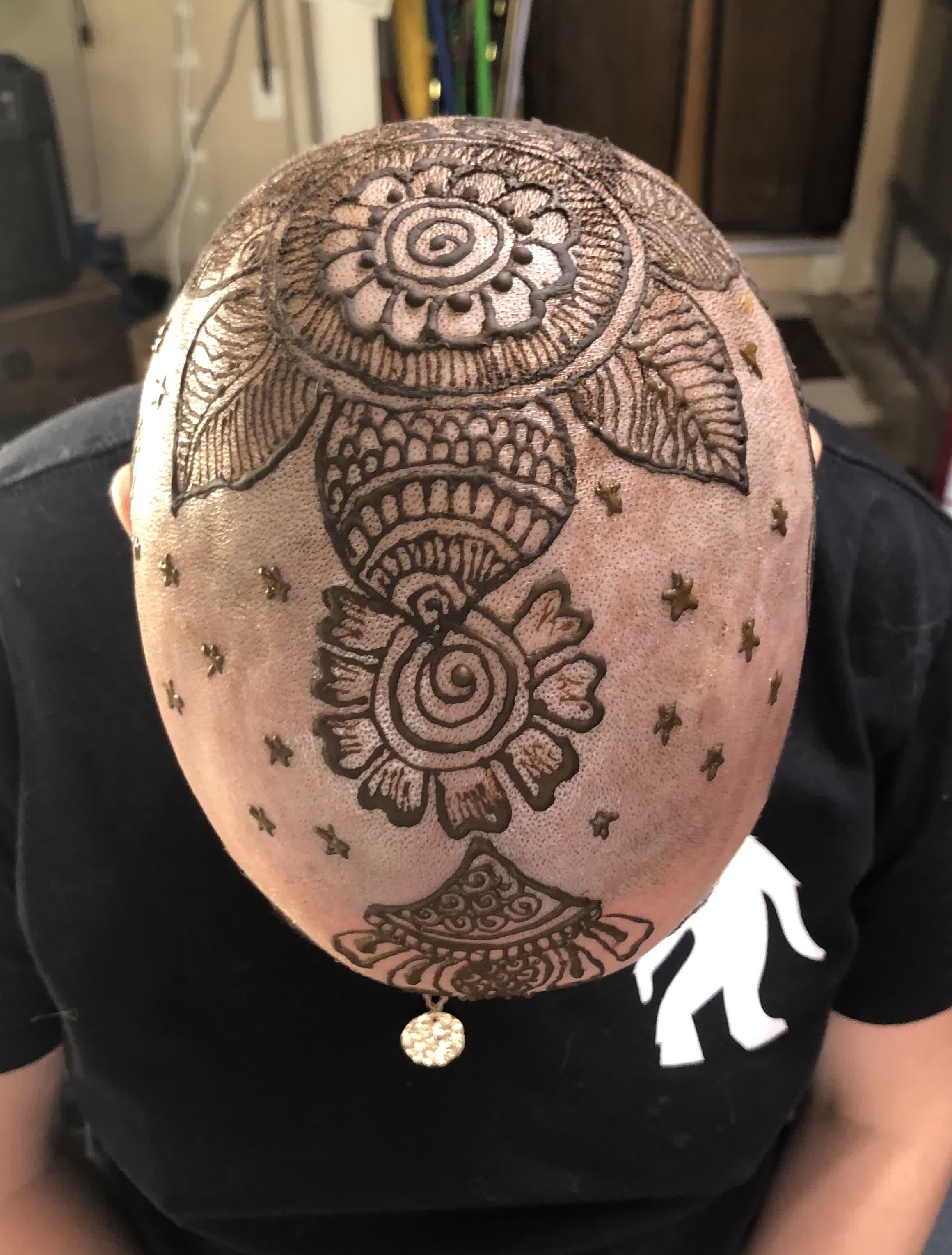 Henna crown design on a cancer patient's scalp, offered as part of Avani Henna's henna for a cause outreach